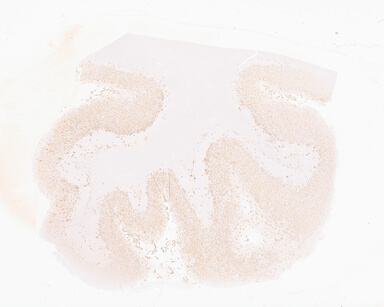 ['deident_6639679c-af53-4c64-a8c2-070b079c4c5c_69d93304.jpg']