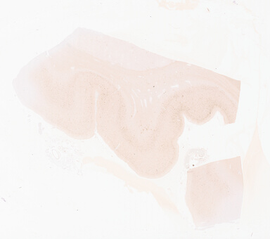 ['deident_8d7424d6-e174-4c69-b895-151f8d079300_69d933a3.jpg']