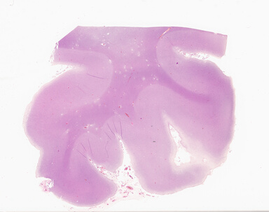 ['deident_eb427f2f-b3dc-4525-b894-acd2e5fd79f8_69d933bf.jpg']