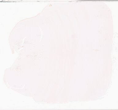 ['deident_ce86c701-e19b-4bd3-bec2-99331d1feaae_69d933bc.jpg']