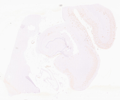 ['deident_e4975e8f-43cb-4d70-83f1-adfbac492b9e_69d933be.jpg']