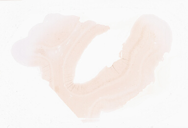 ['deident_7aed9b42-45d0-47a9-9361-689754a02386_69d9339f.jpg']