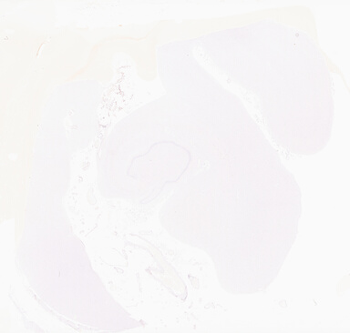 ['deident_00b09161-d5d3-4dc6-a165-9ff6dc27d29c_69d93281.jpg']