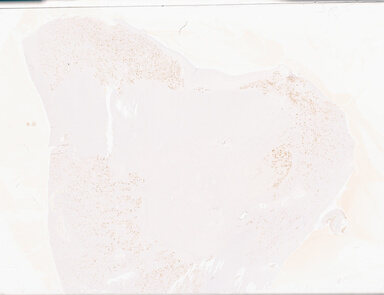 ['deident_0fe36ecd-901e-4c60-9b33-452f1a042337_69d93287.jpg']