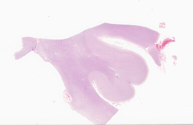 ['deident_b72e097c-e361-425e-b5e0-04e3922f6471_69d933b3.jpg']