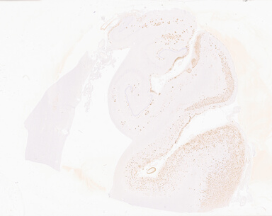 ['deident_2ae0ad28-6a5a-40cf-942a-70c78418f439_69d932c7.jpg']