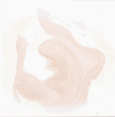 ['deident_c8b0591b-64de-4a90-836f-79dbf26f4bd7_69d933ba.jpg']