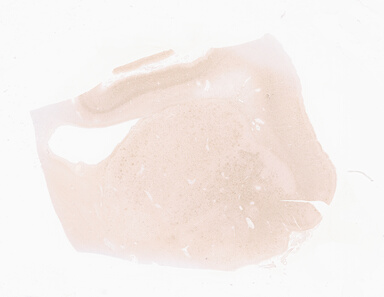 ['deident_42675f0f-d701-4817-89dd-26664cfd971f_69d932ec.jpg']