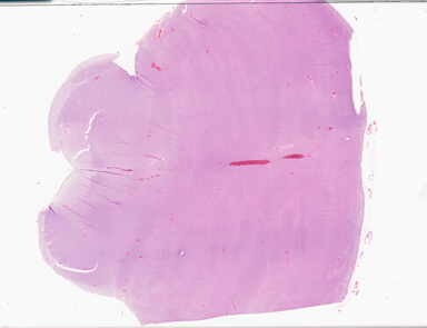 ['deident_35d1f2e7-6e0f-4657-9da8-9d18315e60b7_69d932c8.jpg']