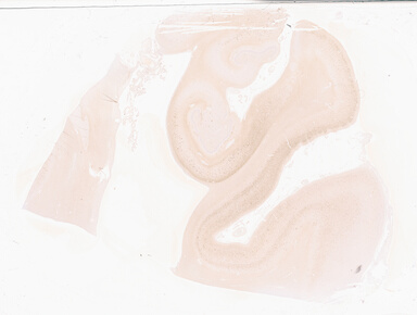 ['deident_75463d44-5731-40ba-a634-af79c5d6d8db_69d9337e.jpg']
