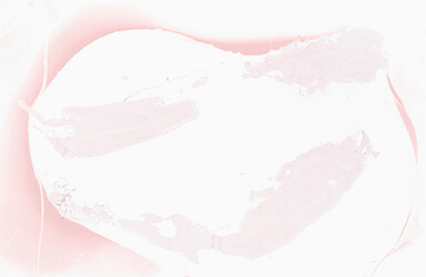 ['deident_ee17e7b2-f5f0-4c66-bad5-37be0fd7bedf_69d933c1.jpg']