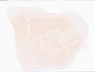 ['deident_2502f307-750f-4b8a-ba19-15e2e9150700_69d932c1.jpg']