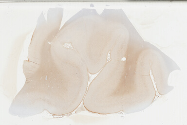 ['deident_c65ce63e-beb6-4762-bda5-bc5ad0048936_695fc6f7.jpg']