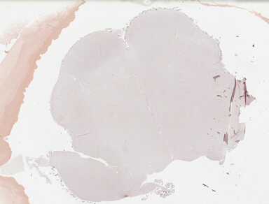 ['deident_74038194-5494-4985-992d-0e2b24494c30_695fc6d7.jpg']