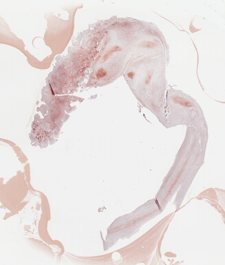 ['deident_2e387c70-fa85-437c-a5cb-b8a95ffbe5b8_695fc6b1.jpg']