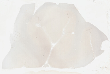['deident_75a948fa-eac9-4cb1-9ed3-f77e696ba4bd_695fc6d9.jpg']
