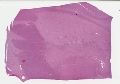 ['deident_7a1d4c79-00da-4a97-98b1-8db5827bddc9_695fc6db.jpg']