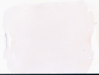 ['deident_5859e5b9-1790-45b1-b900-9341f22f197a_695fc6c2.jpg']