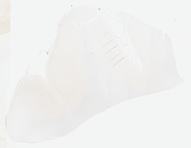 ['deident_37b6585b-7504-41fa-99e0-df9ce50ca2e2_695fc6b8.jpg']