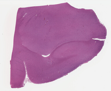 ['deident_dcd1dc2a-be6a-4edb-ad11-7f8ad53c542e_695fc709.jpg']