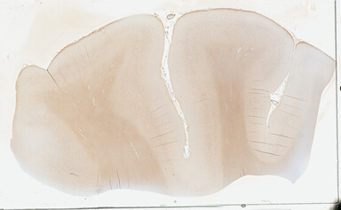 ['deident_702e85ec-f1e7-4888-b2eb-60fbe3d669f0_695fc6d1.jpg']