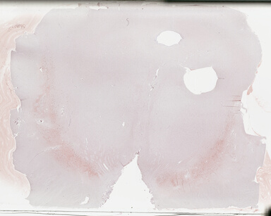 ['deident_81add73b-77f3-44c5-a517-d49147fe4c71_695fc6df.jpg']