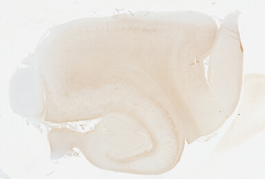 ['deident_b90e3c35-9f25-4f35-8cb0-4ca941318144_695fc6f4.jpg']