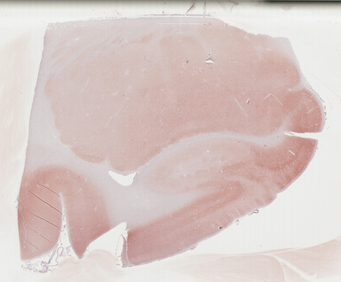 ['deident_234acba6-6cbc-4ca5-83bc-067319749866_695fc6b0.jpg']