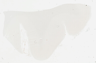 ['deident_9b293633-232c-4e69-b266-5f86d682b0b7_695fc6e7.jpg']
