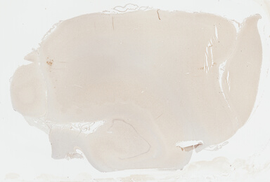 ['deident_9a5d34bf-4d38-44d6-b14c-6711f1b7835b_695fc6e5.jpg']