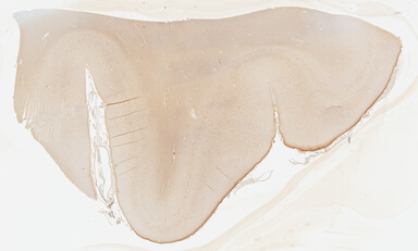 ['deident_e0a3c003-33f7-4e7b-a52e-010667fde35d_695fc70d.jpg']