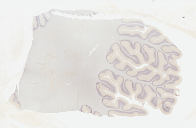 ['deident_5f443510-d471-4cac-aaf7-85804c868e03_695fc6cc.jpg']