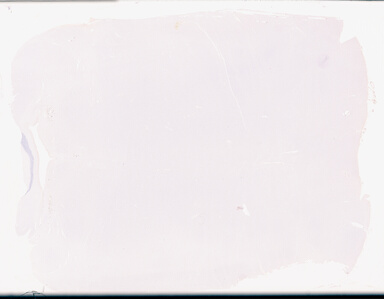 ['deident_726407f5-fb22-42ee-b795-1659cd95913e_695fc6d5.jpg']