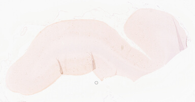 ['deident_02699654-4259-4c84-935f-74b10c96ce34_69d95e91.jpg']