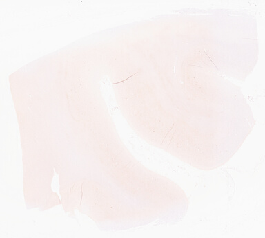 ['deident_6946a1cc-06d8-4eaa-b49c-99f597da78cb_69d95eb7.jpg']