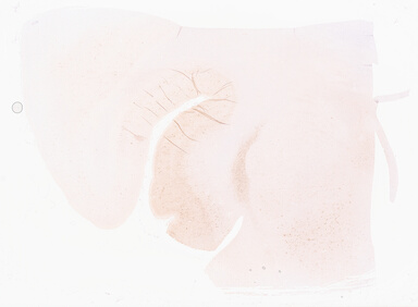 ['deident_632b92cf-c74e-4d1f-9e7d-d93aad23b03b_69d95eb4.jpg']
