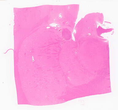 ['deident_5c54fa8b-dd51-4ce0-a137-9a19b24c452d_69d95eaf.jpg']