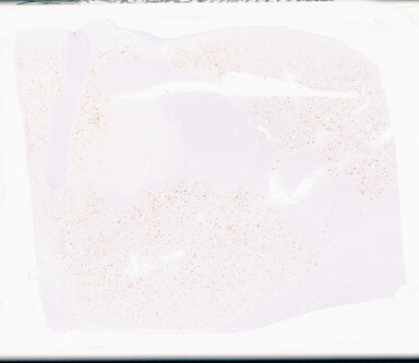 ['deident_7d45296f-8bdd-4311-a7da-ad634b366431_69d95ec5.jpg']