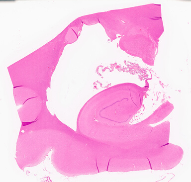['deident_6efd53f9-e955-482d-a64d-bf895c1c7bb2_69d95eba.jpg']