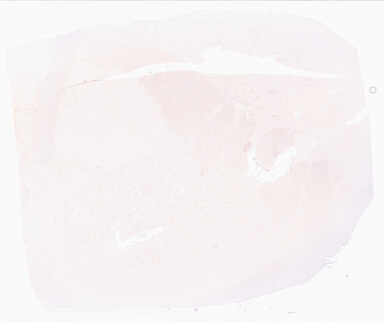 ['deident_71f12912-2d6a-4cc8-826e-62b73e334e95_69d95ebe.jpg']