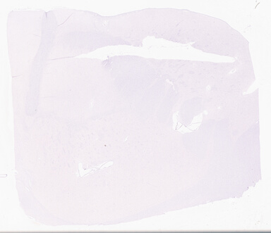 ['deident_f65a2653-7157-45a3-8bda-7d324c98b0ea_69d95f00.jpg']