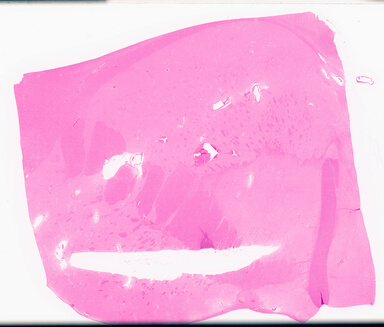 ['deident_b3baca15-359e-494c-bff8-9cbdf89bca05_69d95ee0.jpg']