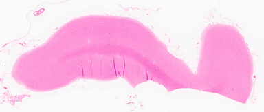 ['deident_8ca4a6ad-7d58-45ab-8025-5b11ca13217f_69d95ecb.jpg']