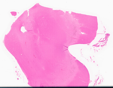 ['deident_9b8688c8-a93b-44fe-9065-160458e299cc_69d95ed1.jpg']