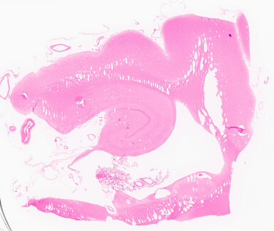 ['deident_2f862eeb-27a3-4182-b149-94e0b551f44a_69d95e9f.jpg']