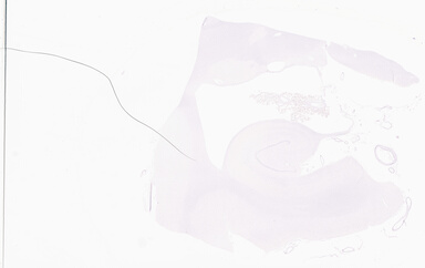['deident_91ccdc4b-79ab-4555-aeb0-cbf426dfae6d_69d95ece.jpg']