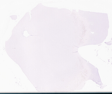 ['deident_2551b715-9041-4100-bc73-cde478087cd9_69d95e9c.jpg']