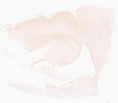 ['deident_77f24b57-9965-4e7e-abb3-50ac370fdd70_69d95ec3.jpg']