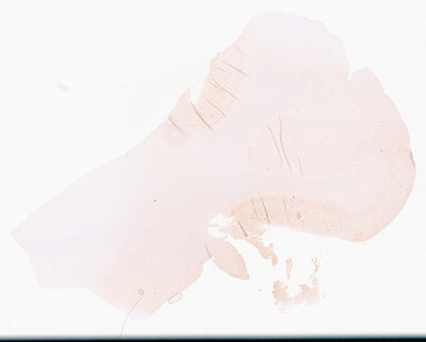 ['deident_0d19f0ce-b190-4245-a5ba-1f5396b05d91_69d95e98.jpg']