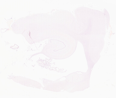['deident_e9496b5a-7dc0-4c84-b569-356b895f55eb_69d95ef4.jpg']